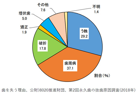 歯を失う理由、公財）8020推進財団、第2回永久歯の抜歯原因調査（2018年）